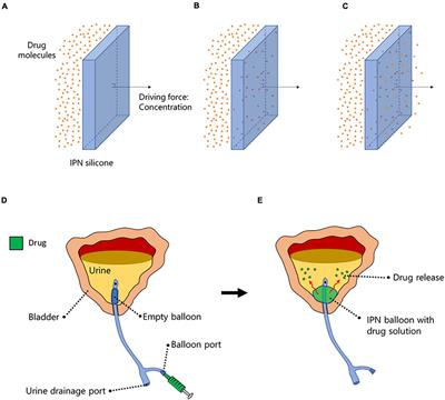 A Novel Device-Integrated Drug Delivery System for Local Inhibition of Urinary Tract Infection